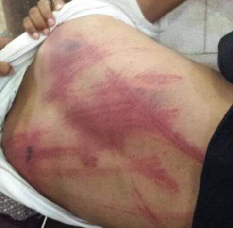 صور مروعة لتعذيب شاب في العاصمة صنعاء على طريقة المغدور به عبدالله الأغبري